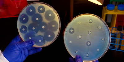 Антибіотикорезистентність в Україні за результатами дослідження AURA (Частина 2)