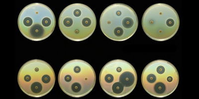 Результати масштабного дослідження антибіотикорезистентності СОАР в Україні