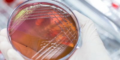 «Кошмарні бактерії» з незвичайною стійкістю до антибіотиків поширюються в США