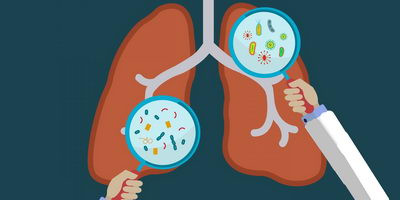 Бактеріофаги проти хронічних інфекцій при муковісцидозі