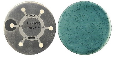 Бактеріофаги проти метицилінрезистентних штамів Staphylococcus aureus