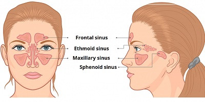 Бактеріофаги в лікуванні хронічних риносинуситів, резистентних до терапії