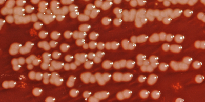 Бактеріофаги проти кишкових інфекцій