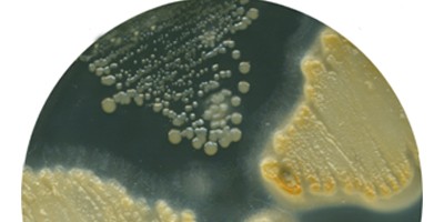 Вивчення чутливості клінічних штамів спектру умовно-патогенних і патогенних мікроорганізмів до препаратів на основі бактеріофагів.