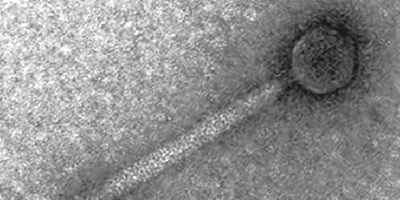 Бактеріофаги проти інфекції Clostridium difficile