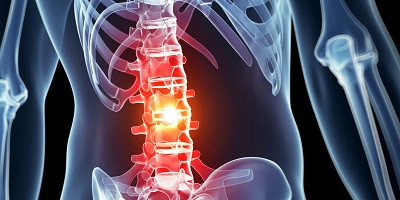 Фаготерапія для пацієнтів після травми спинного мозку